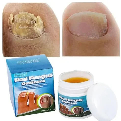 Sumifun - Nail Fungus Ointment (Original)